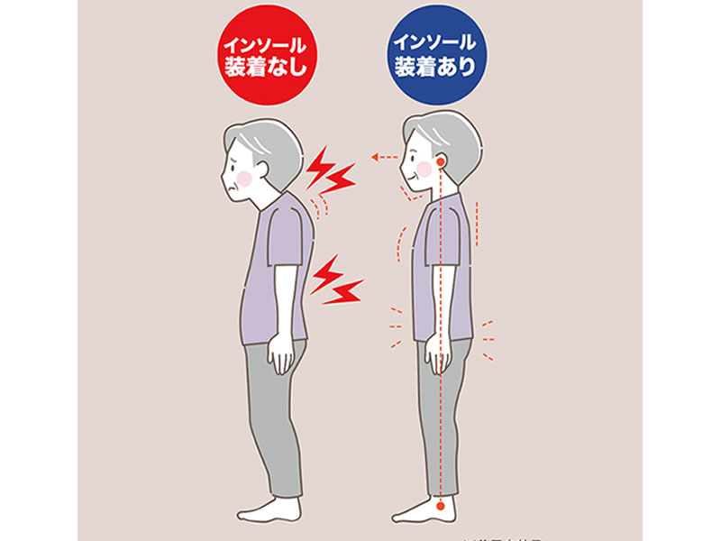 立方骨 特殊構造